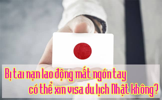 Bi tai nan lao dong mat ngon tay co the xin visa du lich Nhat khong 2
